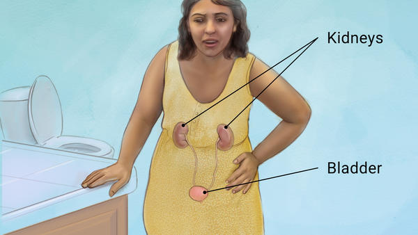 An illustration of how Urinary infection attacks ladies. Internet images.